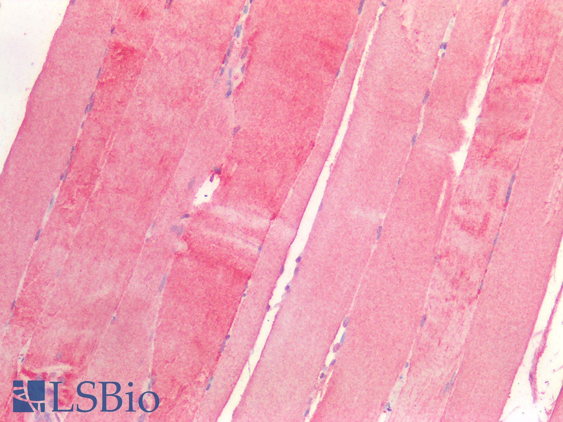 P4HA1 Antibody - Human Skeletal Muscle: Formalin-Fixed, Paraffin-Embedded (FFPE)