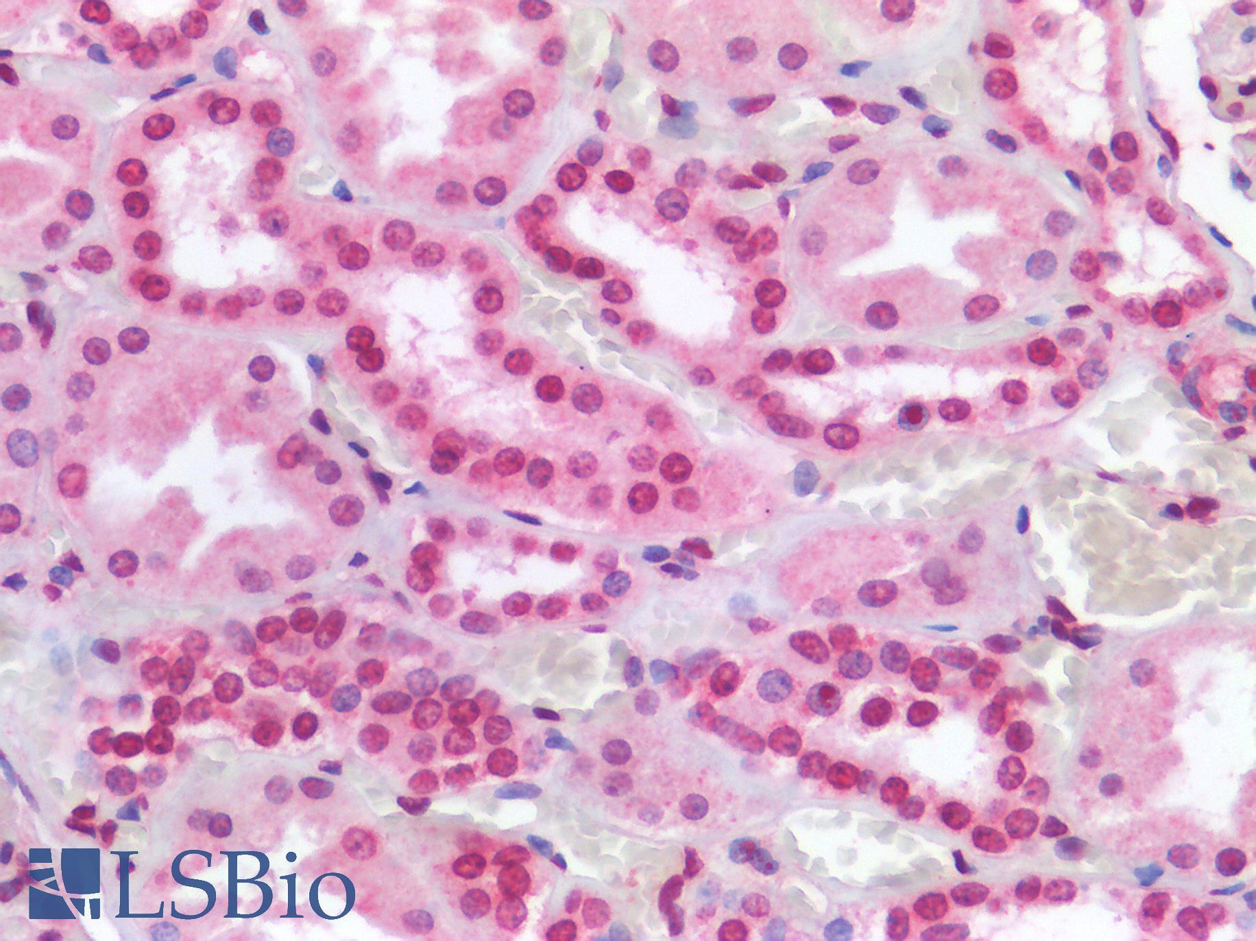 p84 / THOC1 Antibody - Human Kidney: Formalin-Fixed, Paraffin-Embedded (FFPE)