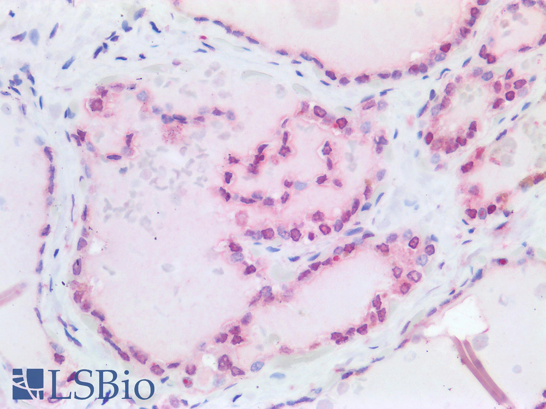 p84 / THOC1 Antibody - Human Thyroid: Formalin-Fixed, Paraffin-Embedded (FFPE)