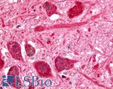 PACE4 / PCSK6 Antibody - Brain, Substantia Nigra