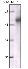 Pan Cytokeratin Antibody - Western blot using CK mouse monoclonal antibody against truncated CK5 recombinant protein.