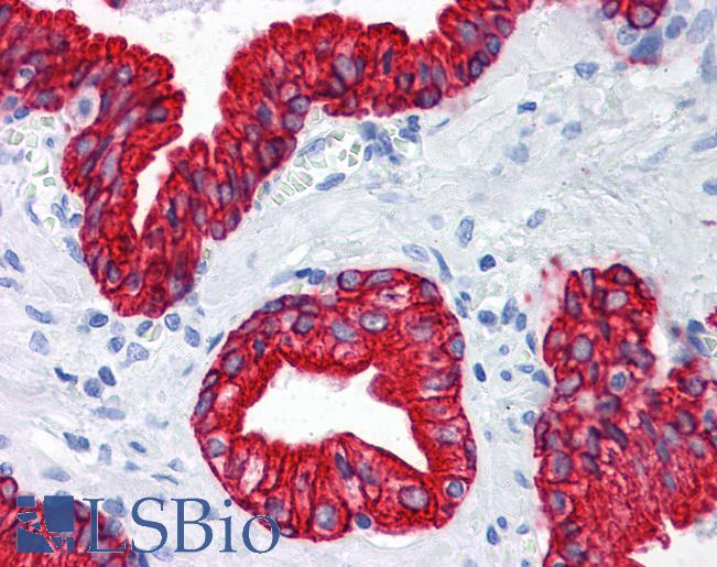 Pan Cytokeratin Antibody - Anti-Keratin antibody IHC of human prostate. Immunohistochemistry of formalin-fixed, paraffin-embedded tissue after heat-induced antigen retrieval. Antibody dilution 1:200.