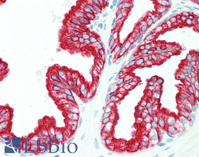 Pan Cytokeratin Antibody - Anti-Pan Cytokeratin antibody IHC staining of human prostate. Immunohistochemistry of formalin-fixed, paraffin-embedded tissue after heat-induced antigen retrieval. Antibody concentration 10 ug/ml.