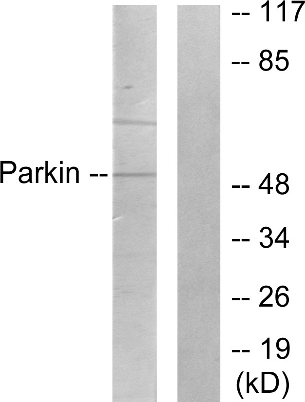 PARK2 / Parkin 2 Antibody - Western blot analysis of lysates from Jurkat cells, using Parkin Antibody. The lane on the right is blocked with the synthesized peptide.