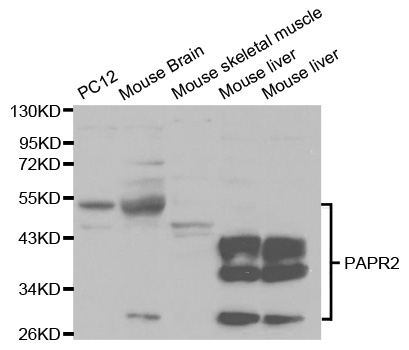 PARK2 / Parkin 2 Antibody - Western blot analysis of various cell lines, using PARK2 antibody.
