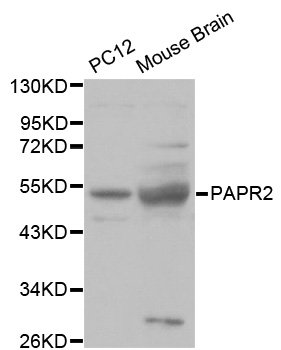 PARK2 / Parkin 2 Antibody - Western blot analysis of extracts of various cell lines, using PARK2 antibody at 1:1000 dilution. The secondary antibody used was an HRP Goat Anti-Rabbit IgG (H+L) at 1:10000 dilution. Lysates were loaded 25ug per lane and 3% nonfat dry milk in TBST was used for blocking.
