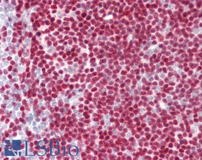 PAX5 Antibody - Human Tonsil: Formalin-Fixed, Paraffin-Embedded (FFPE)