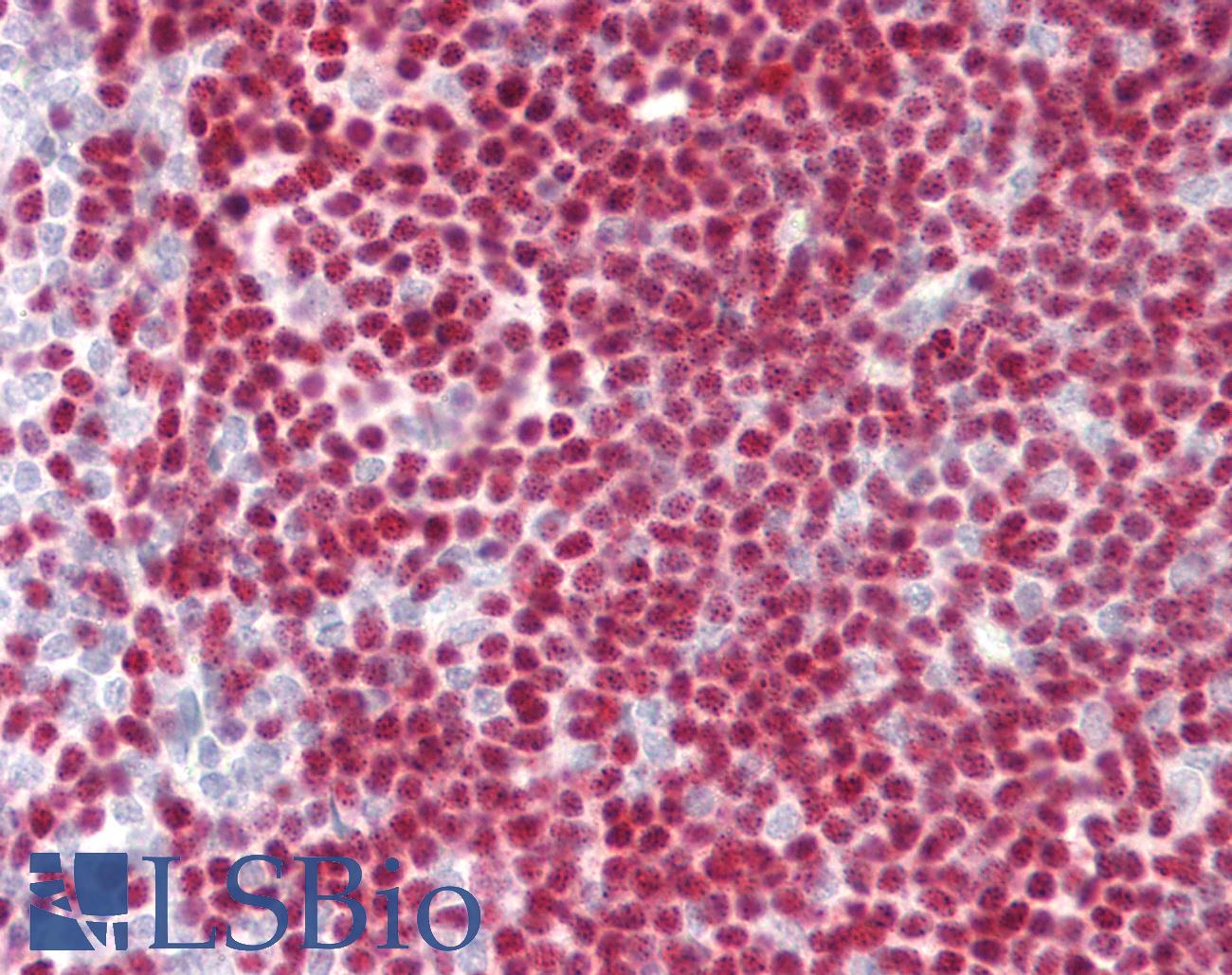 PAX5 Antibody - Human Tonsil: Formalin-Fixed, Paraffin-Embedded (FFPE)