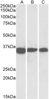 PCNA Antibody - Goat Anti-PCNA (aa111-122) Antibody (0.03µg/ml) staining of NIH3T3 (A), Mouse Testis (B) and Rat Testis (C) lysates (35µg protein in RIPA buffer). Primary incubation was 1 hour. Detected by chemiluminescencence.