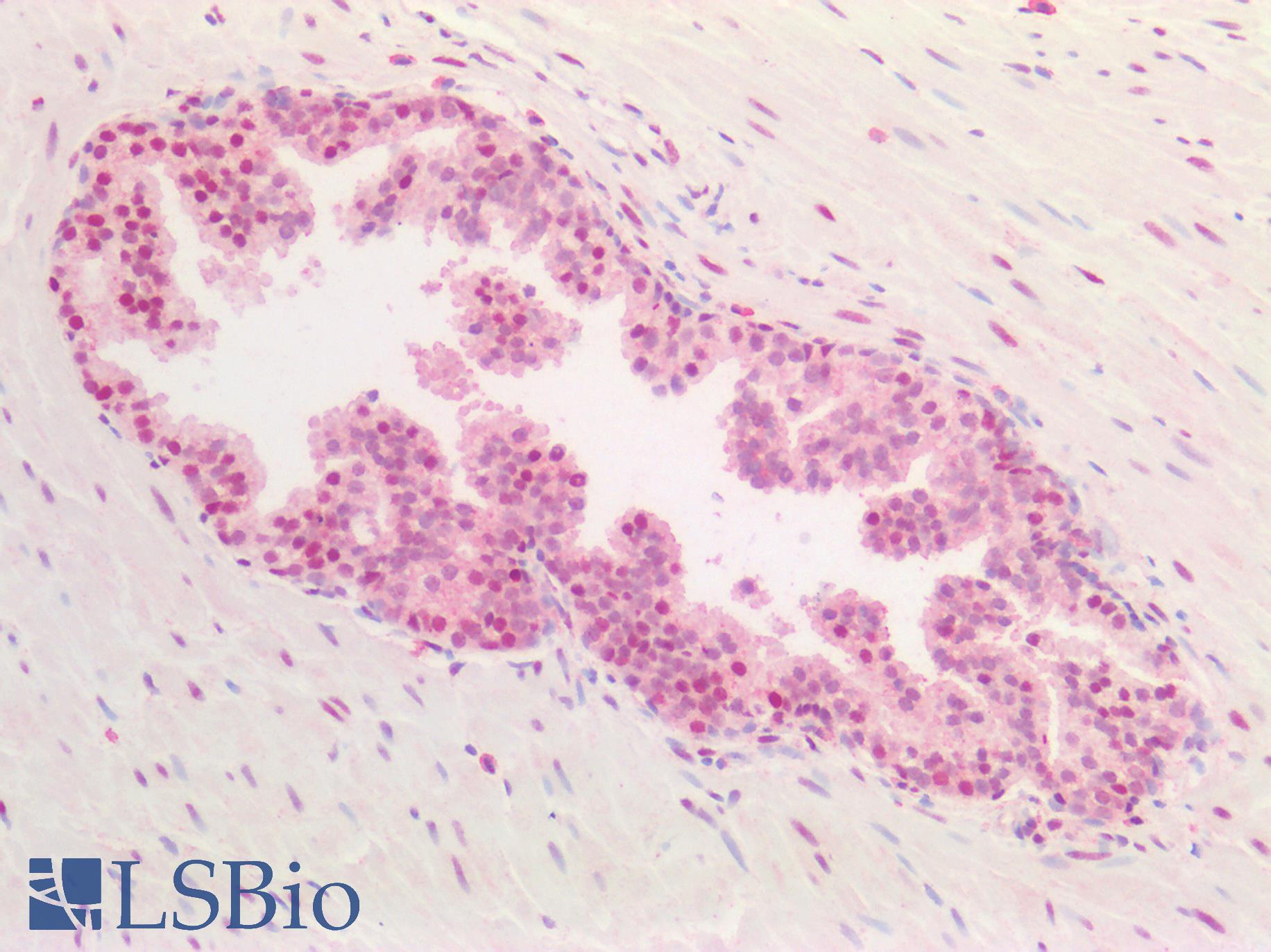 PCNA Antibody - Human Prostate: Formalin-Fixed, Paraffin-Embedded (FFPE)