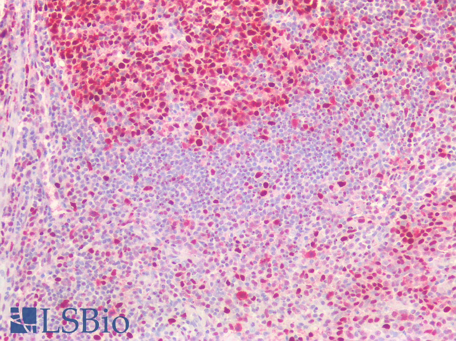 PCNA Antibody - Human Tonsil: Formalin-Fixed, Paraffin-Embedded (FFPE)
