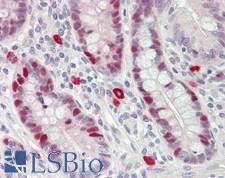 PCNA Antibody - Human Small Intestine: Formalin-Fixed, Paraffin-Embedded (FFPE)