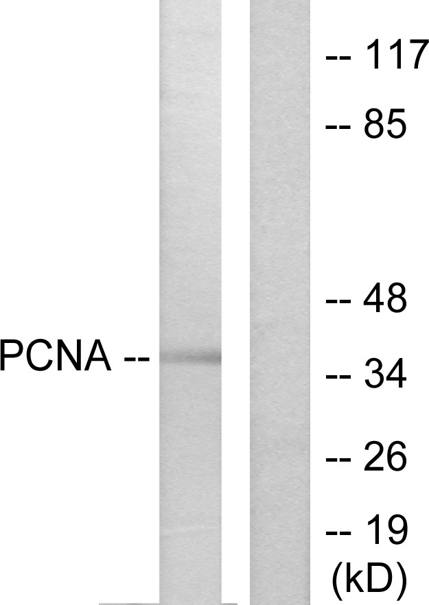 PCNA Antibody - Western blot analysis of lysates from HepG2 cells, using PCNA Antibody. The lane on the right is blocked with the synthesized peptide.