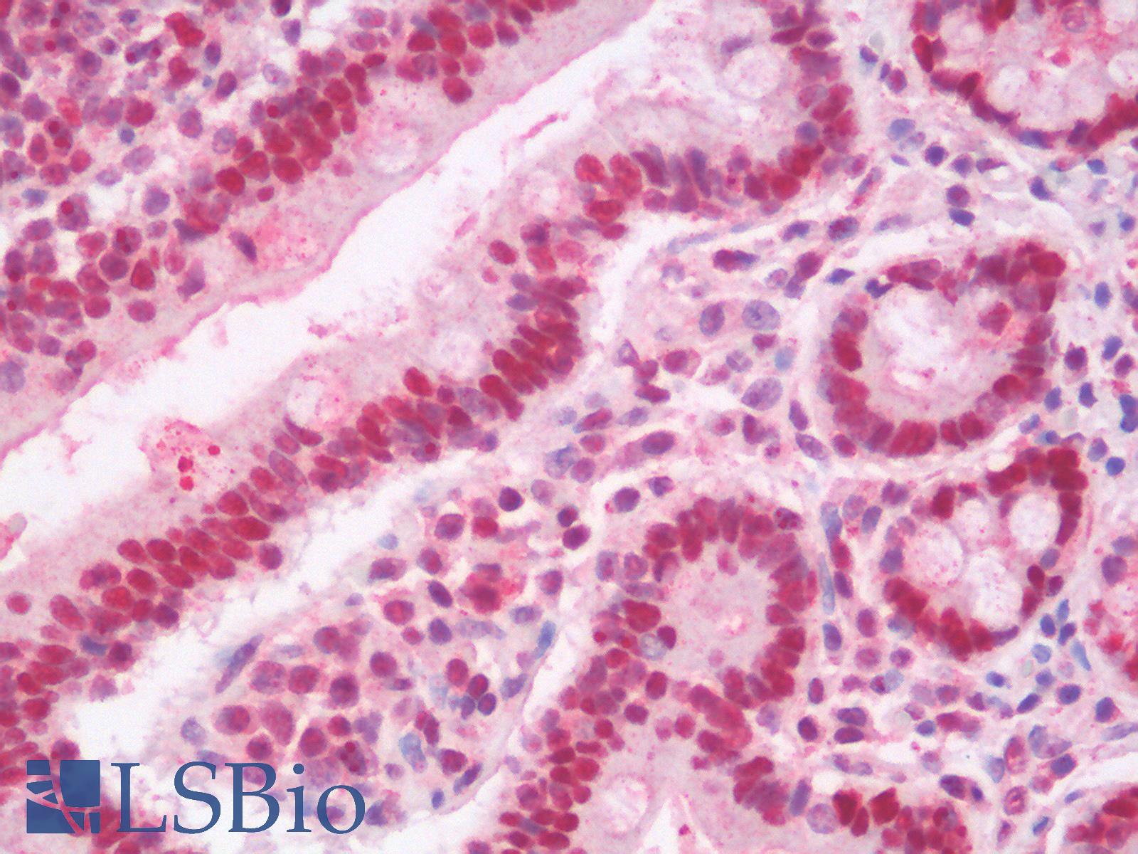 PCNA Antibody - Human Small Intestine: Formalin-Fixed, Paraffin-Embedded (FFPE)