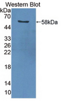 PCNA Antibody - Western Blot; Sample: Recombinant PCNA, Human.