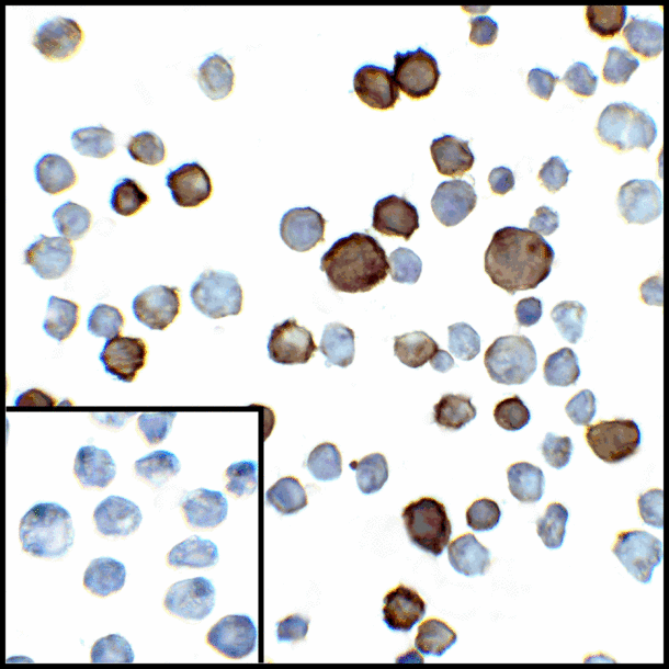 PD-L2 / PDCD1LG2 / CD273 Antibody - Immunocytochemistry of PD-L2 in transfected HEK293 cells with PD-L2 antibody at 5 ug/mL. Lower left: Immunocytochemistry in transfected HEK293 cells with control mouse IgG antibody at 5 ug/mL.