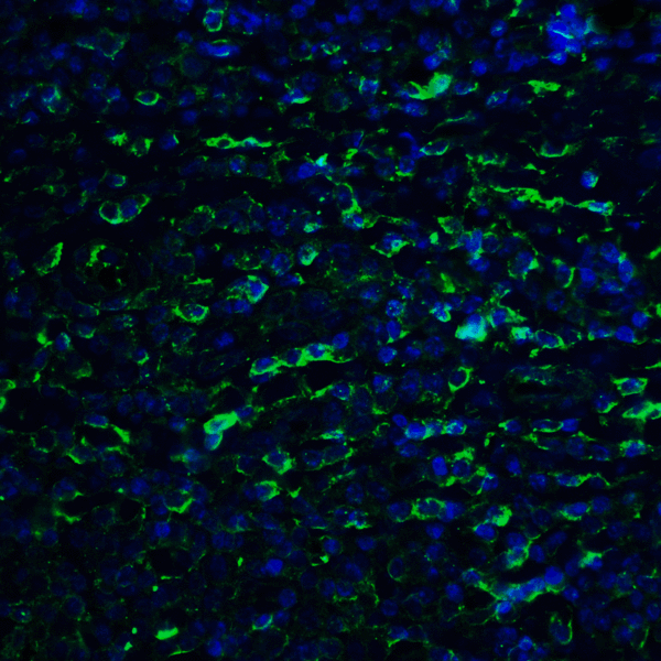 PD-L2 / PDCD1LG2 / CD273 Antibody - Immunofluorescence of PD-L2 in human tonsil tissue with PD-L2 antibody at 20 ug/mL. Green: PDL2 Antibody [10H6] Blue: DAPI staining