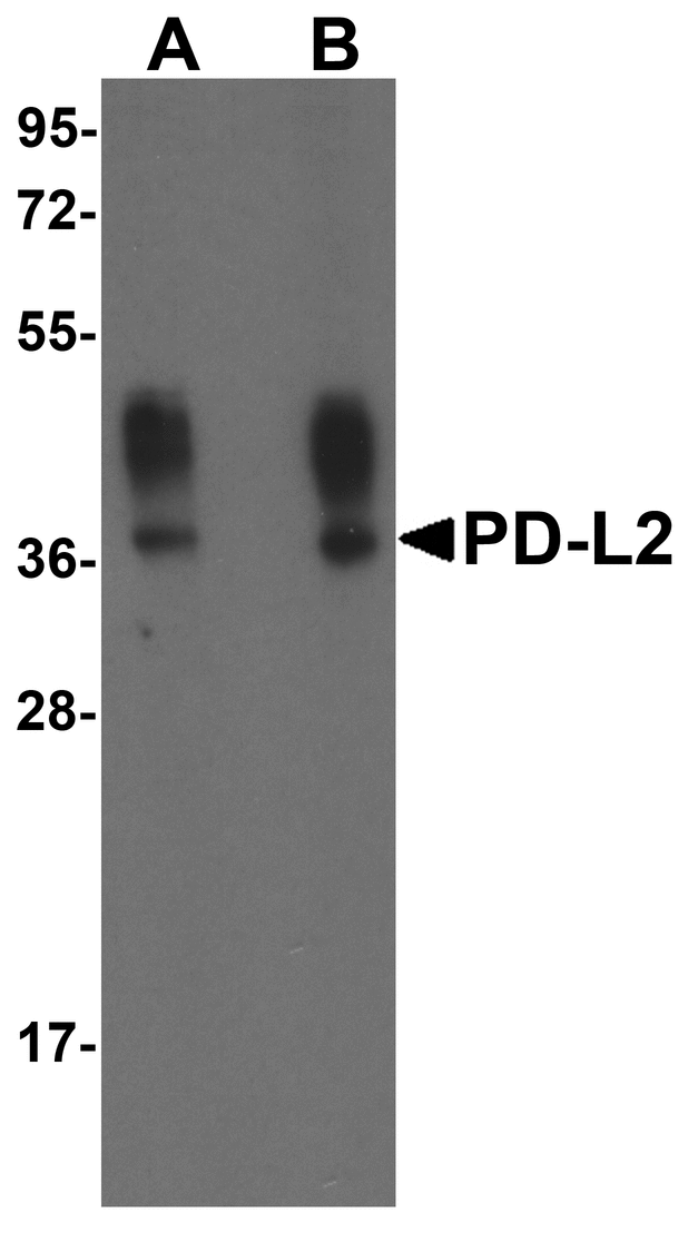PD-L2 / PDCD1LG2 / CD273 Antibody - Western blot analysis of PD-L2 in overexpressing HEK293 cells PD-L2 antibody at 0.5 and 1 ug/ml