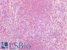 PD-L2 / PDCD1LG2 / CD273 Antibody - Human Spleen: Formalin-Fixed, Paraffin-Embedded (FFPE)