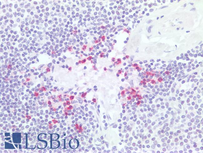 PDCD1 / CD279 / PD-1 Antibody - Human Spleen: Formalin-Fixed, Paraffin-Embedded (FFPE)
