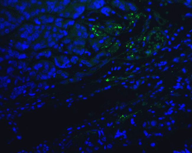 PDCD1 / CD279 / PD-1 Antibody - Immunofluorescence of PD-1 in human lymph node tissue with PD-1 antibody at 20 ug/mL. Green: PD1 Antibody [10B3] (RF16005) Blue: DAPI staining