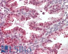 PDCD4 Antibody - Human Uterus: Formalin-Fixed, Paraffin-Embedded (FFPE)