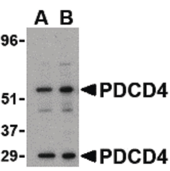 PDCD4 Antibody - Western blot of PDCD4 in A-20 cell lysate with PDCD4 antibody at (A) 0.5 and (B) 1ug/ml.