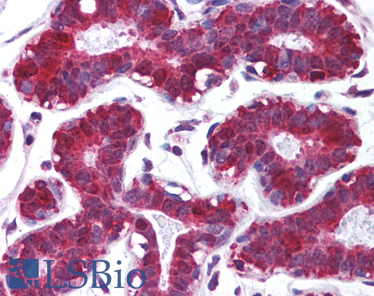 PDCD4 Antibody - Anti-PDCD4 antibody IHC of human breast. Immunohistochemistry of formalin-fixed, paraffin-embedded tissue after heat-induced antigen retrieval. Antibody concentration 5 ug/ml.