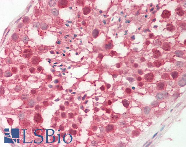 PDGF-CC Antibody - Human Testis: Formalin-Fixed, Paraffin-Embedded (FFPE).  This image was taken for the unconjugated form of this product. Other forms have not been tested.