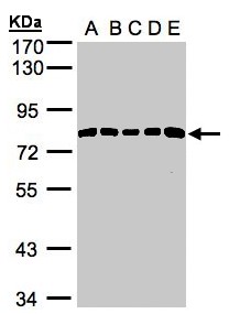 PDGFRA / PDGFR Alpha Antibody - Sample(30g of whole cell lysate). A: 293T. B: A431. C: H1299. D: HeLa S3. E: Hep G2. 7.5% SDS PAGE. PDGFRA antibody diluted at 1:1000