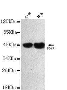 PDH / Pyruvate Dehydrogenase Antibody - PDHA1 (C-terminus) antibody at 1/3000 dilution Lane1:A549 whole cell lysate 40 ug/Lane Lane2: HeLa whole cell lysate 40 ug/Lane.