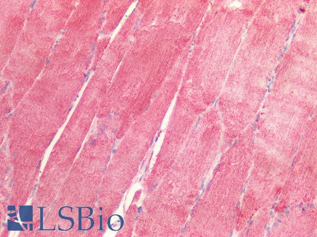 PDH / Pyruvate Dehydrogenase Antibody - Human Skeletal Muscle: Formalin-Fixed, Paraffin-Embedded (FFPE)