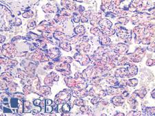PECAM-1 / CD31 Antibody - Human Placenta, Endothelium: Formalin-Fixed, Paraffin-Embedded (FFPE)