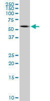 Peripherin Antibody - Western blot of PRPH expression in IMR-32.