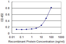 Peripherin Antibody - Detection limit for recombinant GST tagged PRPH is 1 ng/ml as a capture antibody.
