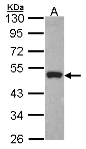 Peripherin Antibody - Sample (30 ug of whole cell lysate). A: Hela. 10% SDS PAGE. Peripherin antibody. Peripherin antibody diluted at 1:1000.
