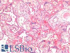 PEX19 Antibody - Human Placenta: Formalin-Fixed, Paraffin-Embedded (FFPE)