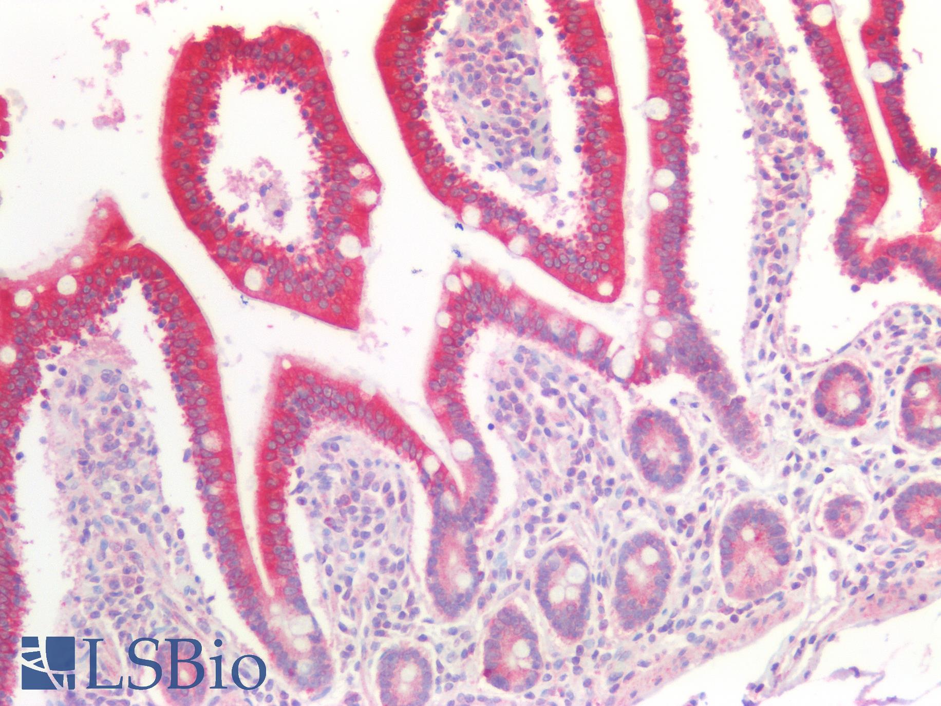 PEX19 Antibody - Human Small Intestine: Formalin-Fixed, Paraffin-Embedded (FFPE)