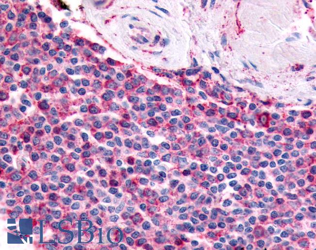 PGES / PTGES Antibody - Anti-PGES / PTGES antibody IHC of human spleen. Immunohistochemistry of formalin-fixed, paraffin-embedded tissue after heat-induced antigen retrieval.