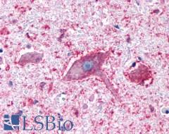 PGR1 / GPR153 Antibody - Brain, Medulla, Hypoglossal nucleus