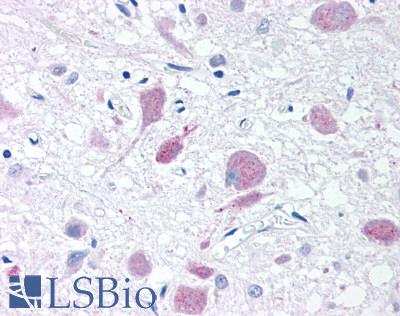 PLA2G3 Antibody - Brain, Hypothalamus, neurons