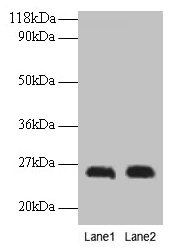 Placental Lactogen Antibody - Western blot All lanes: Chorionic somatomammotropin hormone antibody at 2µg/ml Lane 1: A549 whole cell lysate Lane 2: u251 whole cell lysate Secondary Goat polyclonal to rabbit IgG at 1/15000 dilution Predicted band size: 25 kDa Observed band size: 25 kDa