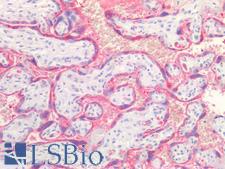 Placental Lactogen Antibody - Human Placenta: Formalin-Fixed, Paraffin-Embedded (FFPE)