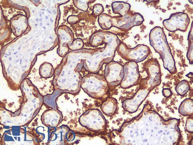 PLAP / Alkaline Phosphatase Antibody - Human Placenta: Formalin-Fixed, Paraffin-Embedded (FFPE)