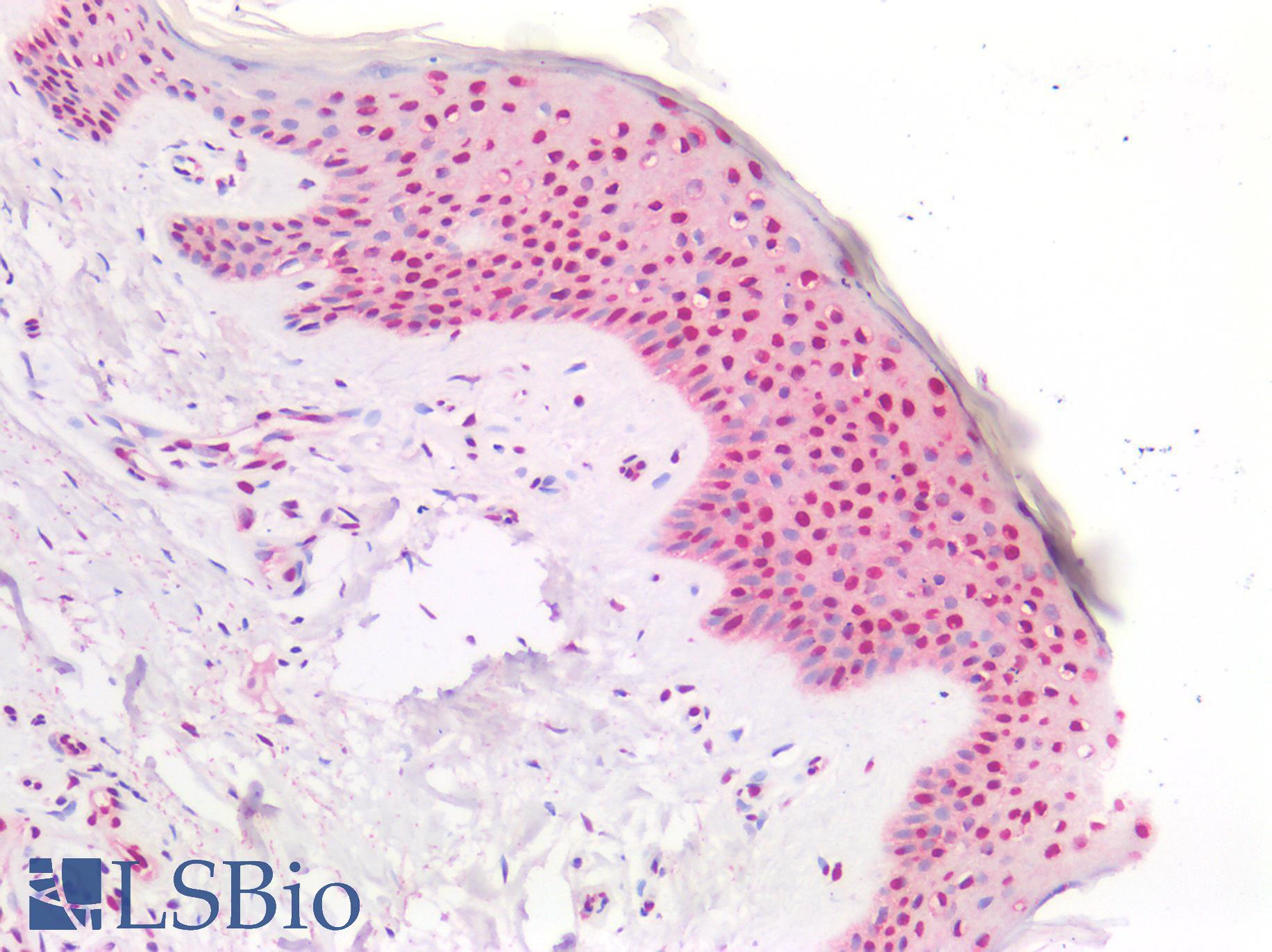 PLEKHG5 Antibody - Human Skin: Formalin-Fixed, Paraffin-Embedded (FFPE)