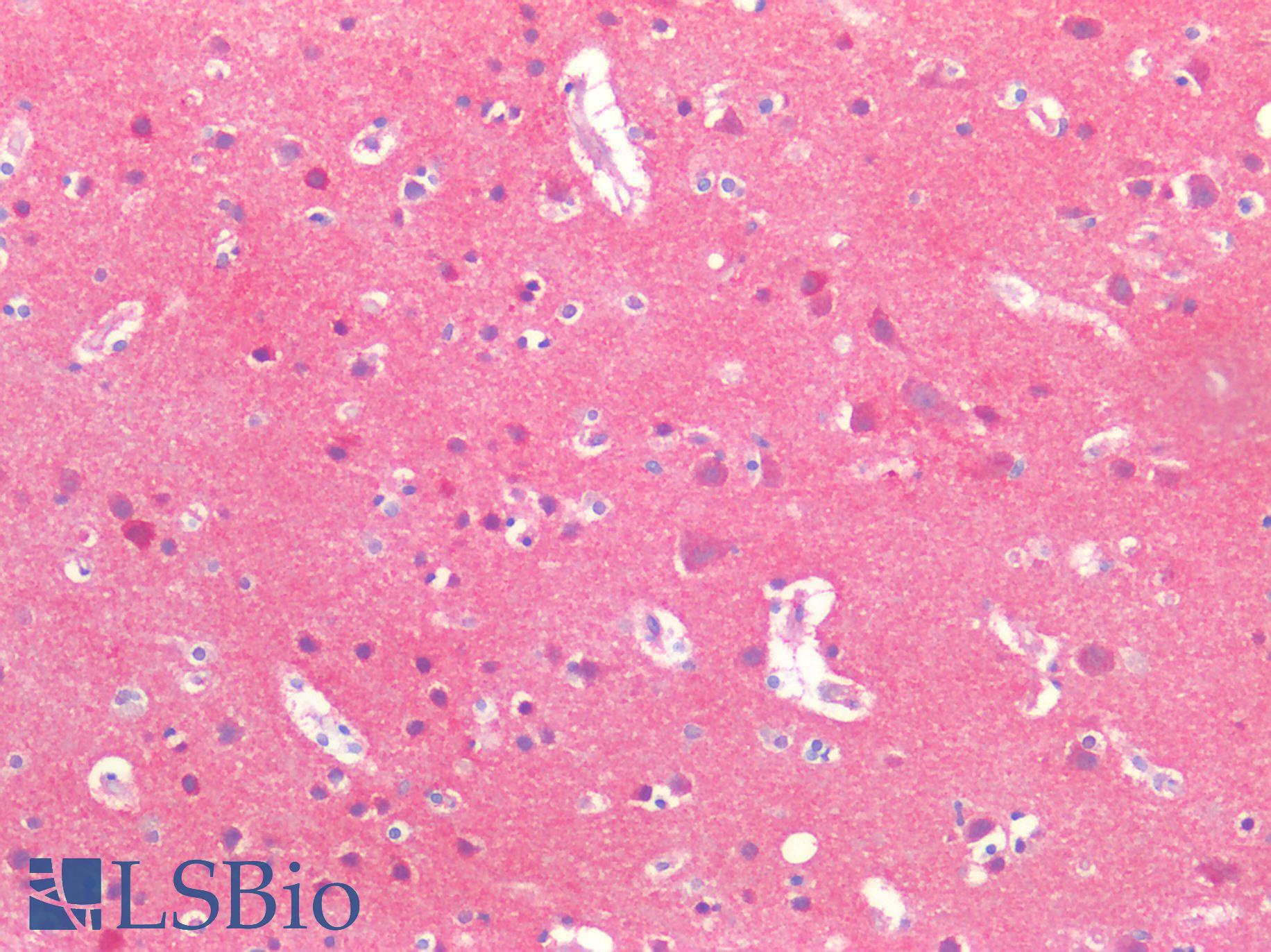 POSTN / Periostin Antibody - Human Brain, Cortex: Formalin-Fixed, Paraffin-Embedded (FFPE)