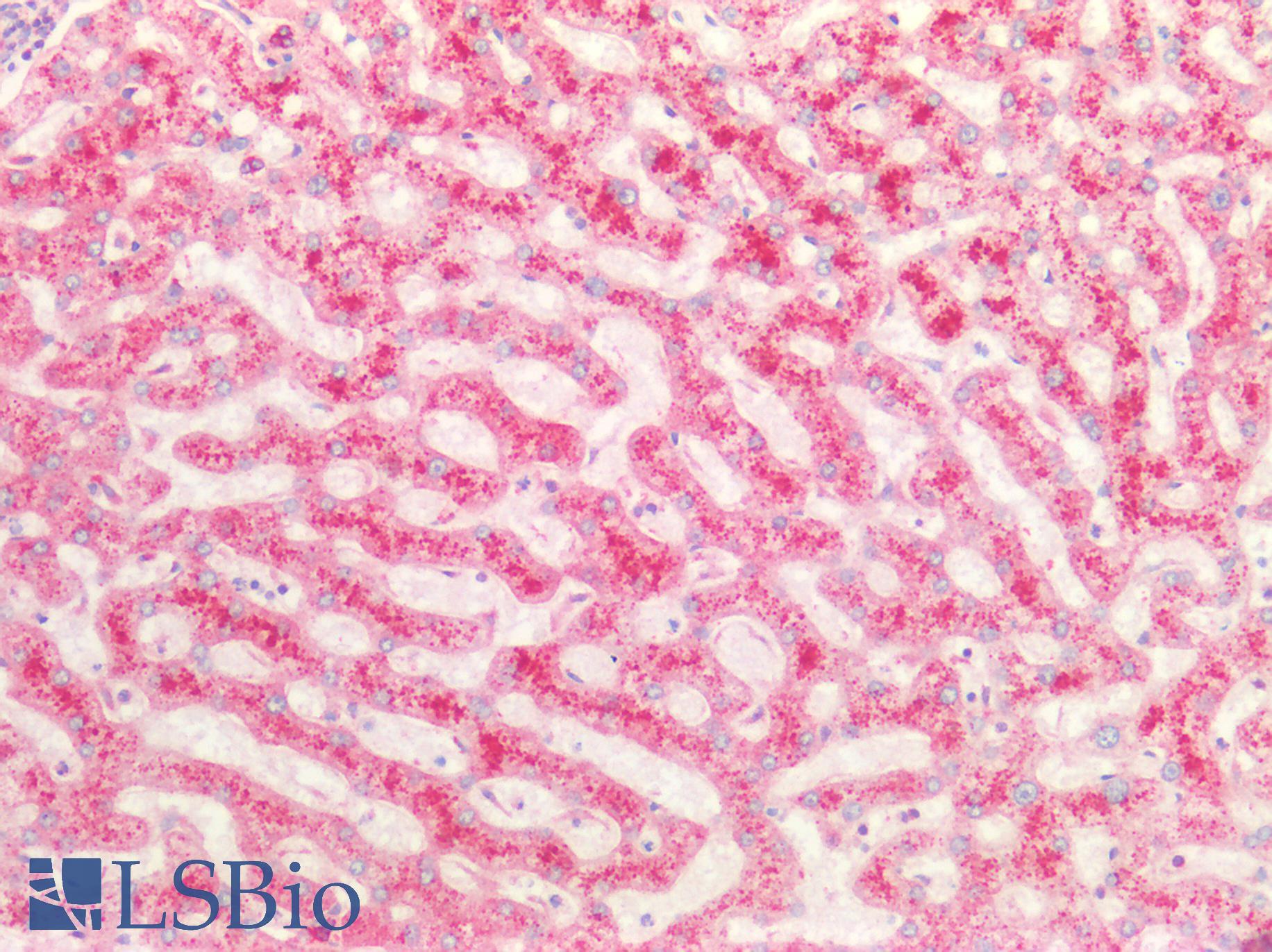 POSTN / Periostin Antibody - Human Liver: Formalin-Fixed, Paraffin-Embedded (FFPE)