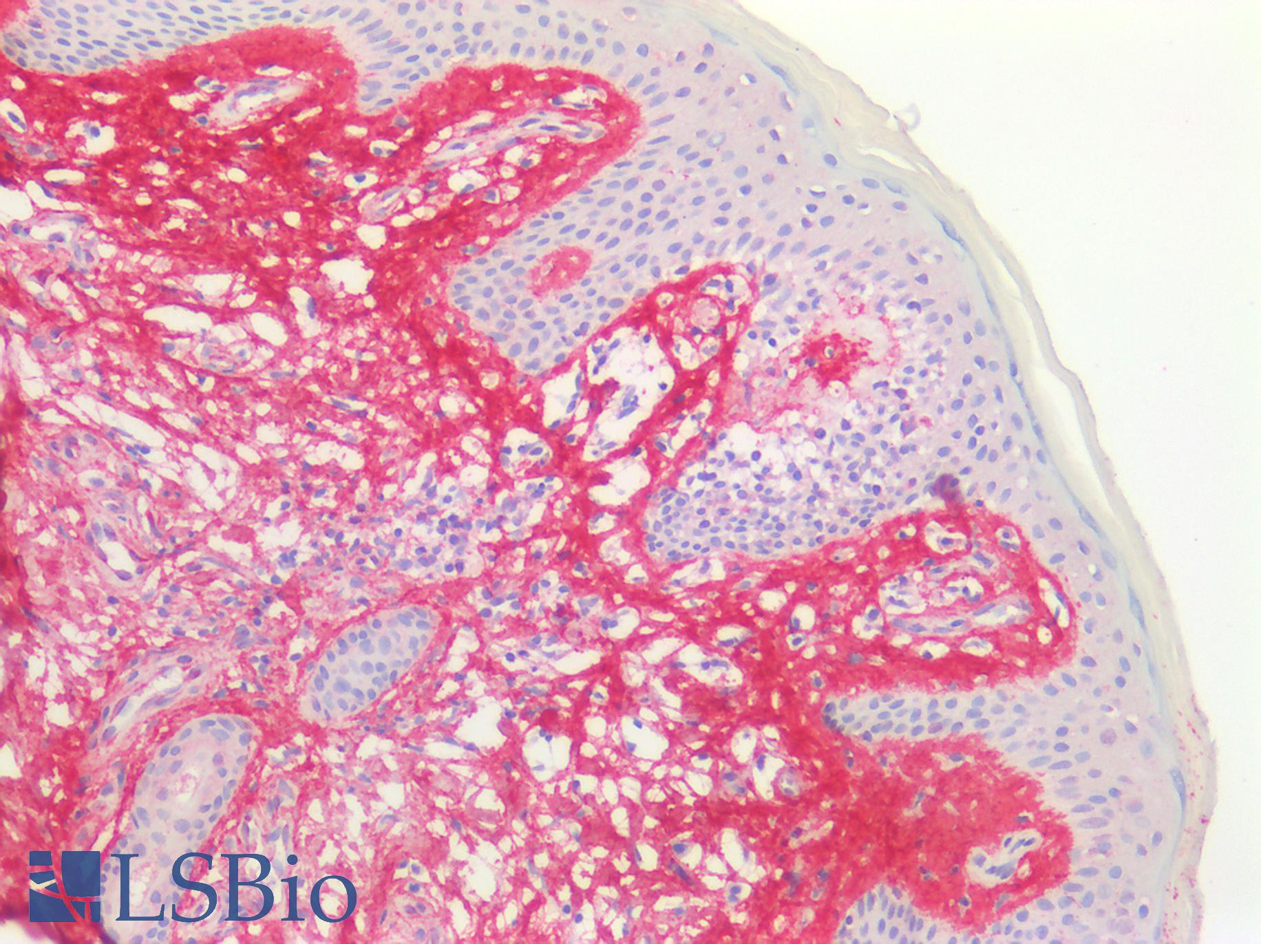 POSTN / Periostin Antibody - Human Skin, Paraffin-Embedded (FFPE)