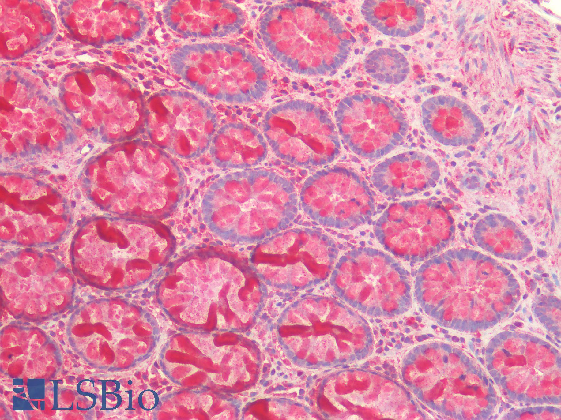 PRDX3 / Peroxiredoxin 3 Antibody - Human Colon: Formalin-Fixed, Paraffin-Embedded (FFPE)