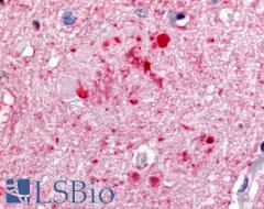 PRKCZ / PKC-Zeta Antibody - Brain, Alzheimer's disease senile plaque